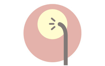 内視鏡検査